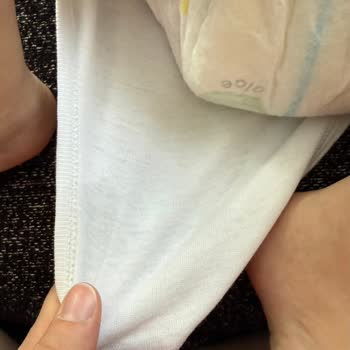Prima Aktif Bebek Bezlerinde Kalite Düşüşü Ve Sızdırma Sorunu