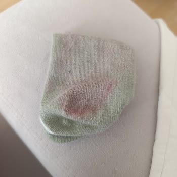 FLO Çocuk Terliğinin Boya Bulaştırması Ve Mağaza Çözümsüzlüğü