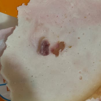 Pınar Hindi Füme Ürünün İçinde Yabancı Cisim Bulunması