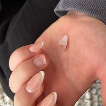 Dr. Rene Sadece Çay İçerken Tırnağım Kökünden Düştü
