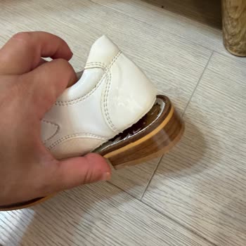 Ayıplı Sünnet Ayakkabısı Ve İade Sürecinde Mağazanın Sorumsuz Tutumu