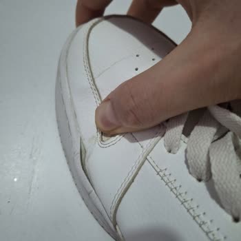 Sadece 8 Kez Kullanılan Skechers Ayakkabısının Tabanı Açıldı Ve Garanti Reddedildi