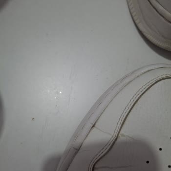 Sadece 8 Kez Kullanılan Skechers Ayakkabısının Tabanı Açıldı Ve Garanti Reddedildi