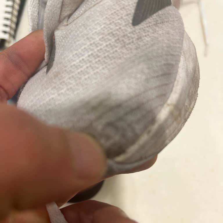Deichmann'de Adidas Ayakkabıda 15 Günlük Kullanımda Açılma Ve Kullanıcı Hatası İddiası