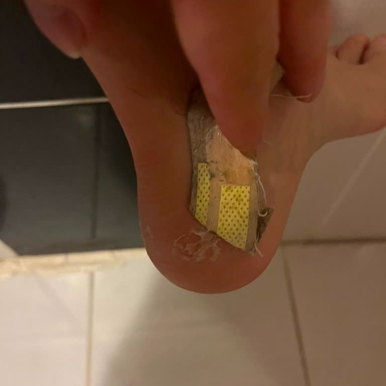 Sneaks Up Ayakkabısının İç Soyulması Ve Tahrişi Nedeniyle Değişim Talebim Reddedildi