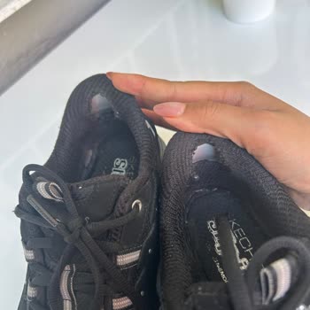 Skechers Ayakkabısının Kısa Sürede Yırtılması Ve Mağaza Tarafından Kullanıcı Hatası İddiası