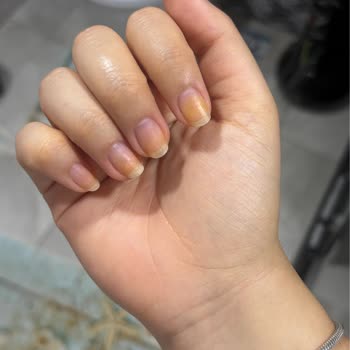 Flormar Nail Enamel 543 SPA Day Ojesi Tırnaklarda Belirgin Sararmaya Neden Oldu