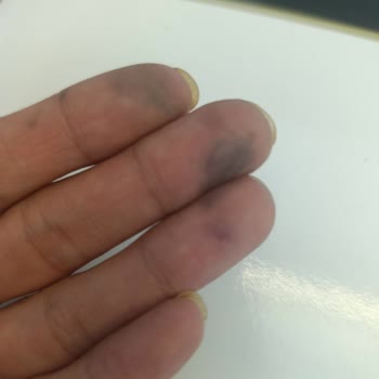 Başkent Ata Fırın Aldığım Pastadan Ciddi Şekilde Mağdur Oldum