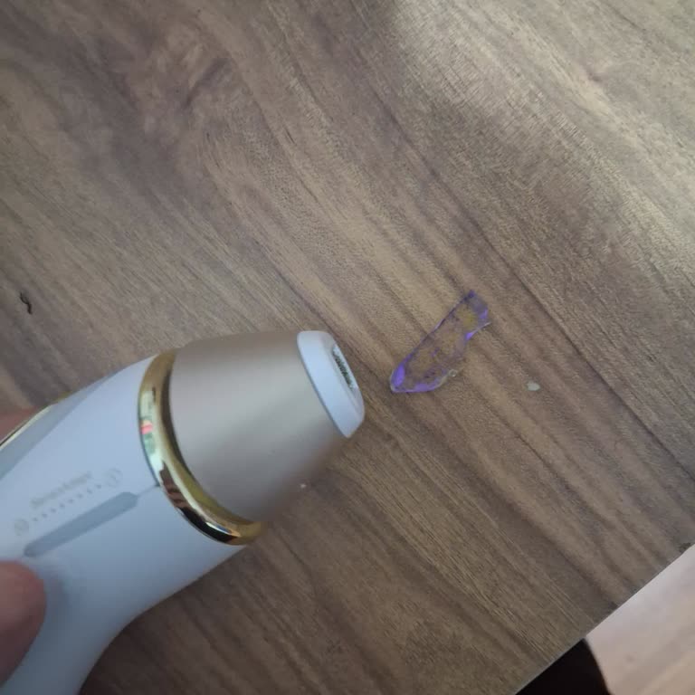 Patlayan Lazer Cihazı Ve Orijinal Olmayan Braun Ürünü Nedeniyle Güvenlik Mağduru