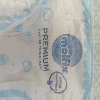 Molfix Premium Bebek Bezlerinde Ortadaki Çizik Nedeniyle Sızıntı Sorunu