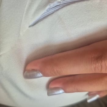 Fermuar Sorunu Yüzünden Pantolon Kullanılamaz, Onarım Ve Masraf Telafisi Talep Ediyorum