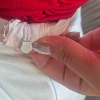 Fermuar Sorunu Yüzünden Pantolon Kullanılamaz, Onarım Ve Masraf Telafisi Talep Ediyorum