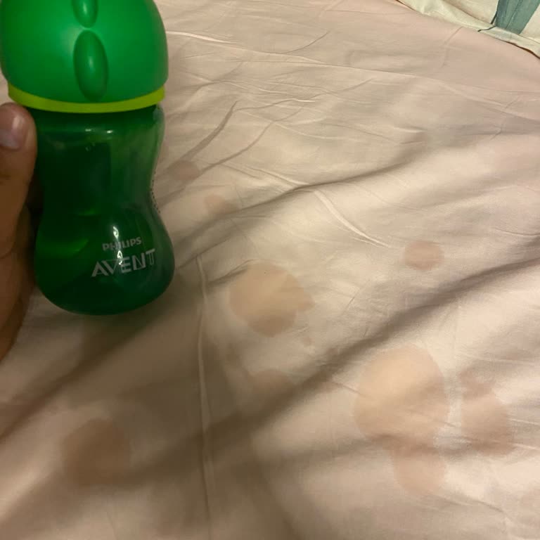 Philips Avent Bebek Suluğu Sızdırıyor Ve Değişim Talebim