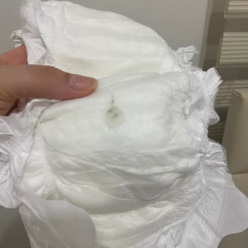 Bebek Bezinde Tırtıklı Ve Batıcı Bölge, Yapışkan Madde Ve Lekelerle Karşılaşılan Sağlık Endişesi