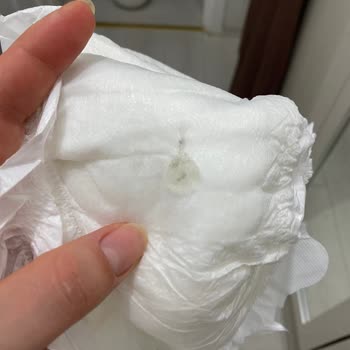 Bebek Bezinde Tırtıklı Ve Batıcı Bölge, Yapışkan Madde Ve Lekelerle Karşılaşılan Sağlık Endişesi