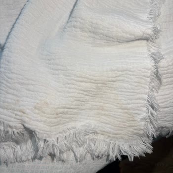 Tiny Lamb'dan Üst Üste Yanlış Ve Kirli Ürün Gönderimi Ve Cevapsızlık