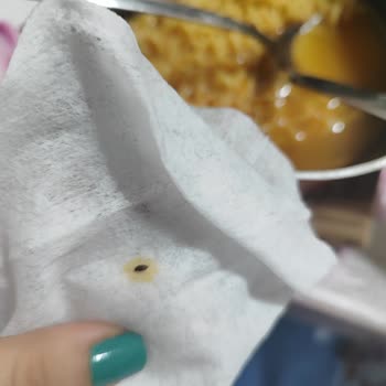 İndomie Köri Soslu Noodle Ürününde Böcek Keşfi Sağlık Endişesi