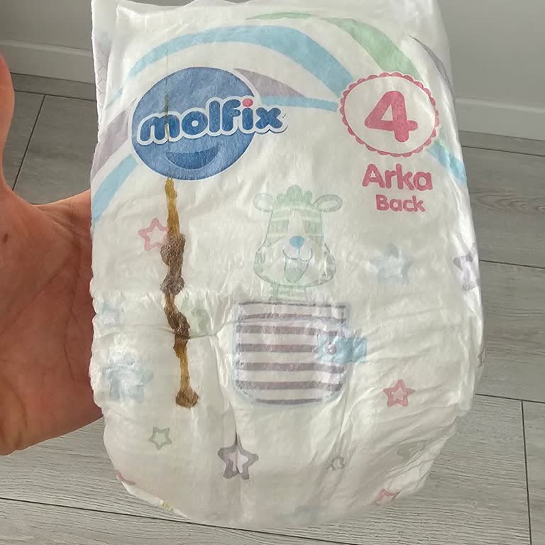 Molfix Bebek Bezinde Kahverengi Lekeler Ve Cevapsız İletişim