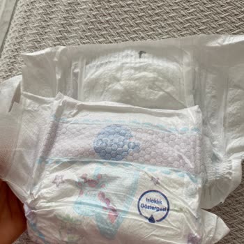 Molfix Bebek Bezinde Siyah Leke Ve Hijyen Endişesi