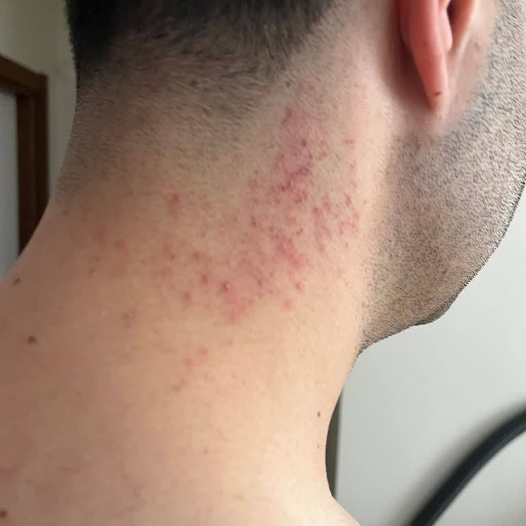 Epify Glutathione Shot Ürünü Alerjik Reaksiyon Ve Yanıltıcı Tanıtım Nedeniyle İade Talebi