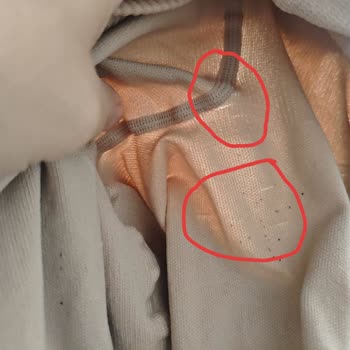 Medi Mediven Lipödem Taytının Bir Ayda Deforme Olması Ve İade Talebi