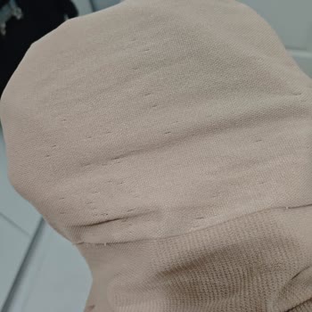 Medi Mediven Lipödem Taytının Bir Ayda Deforme Olması Ve İade Talebi