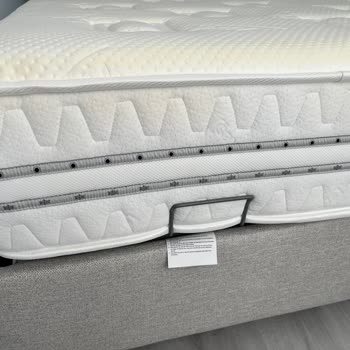 Prestige Prime Yatağındaki Sararma Ve Uzayan Servis Süreci