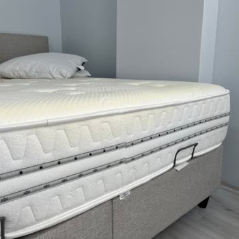 Prestige Prime Yatağındaki Sararma Ve Uzayan Servis Süreci