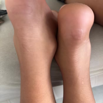 Vicco Pozcu Şubesinde Yanlış Numara Ve Saygısız Çalışanlar Nedeniyle Çocuğumun Ayağı Yaralandı