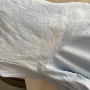 BİM Dagi Şortlu Pijama Takımının Renk Atması ve İade Talebi