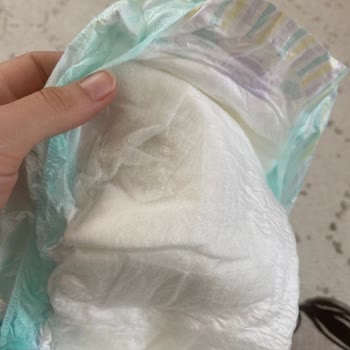 Jenny Willy Bebek Bezinde Sert Topaklar Bebek Sağlığını Tehdit Ediyor