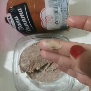 Maret Kavurmasında Büyük Kemik Parçası Çıktı, Boğazıma Takıldı Ve Dişim Düştü