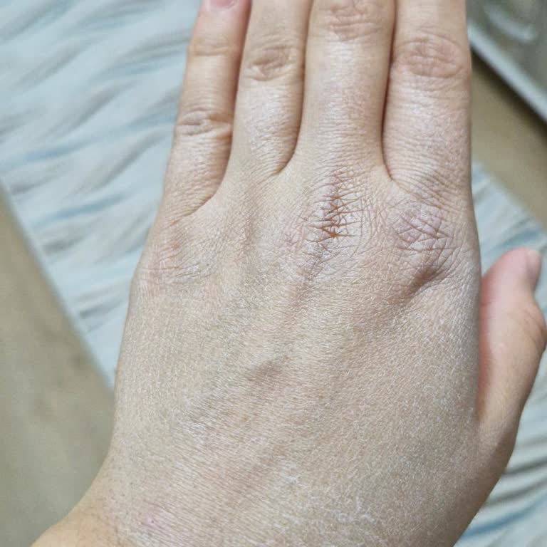 Kapağı Bozuk Ve Beyaz Tabaka Bırakan Güneş Kremi İçin Ücret İadesi Talebi