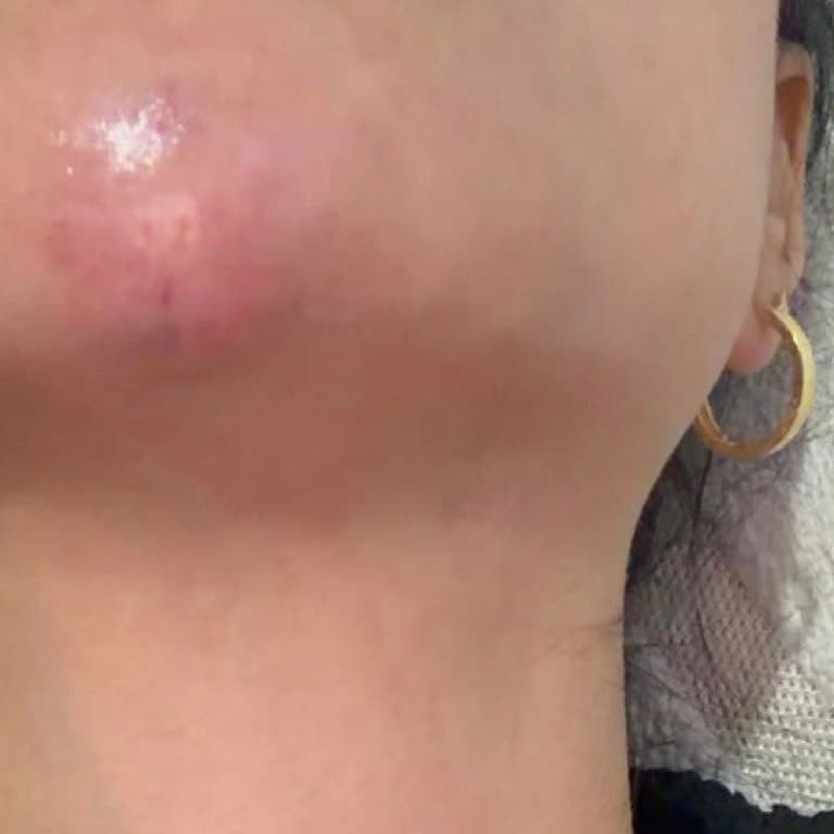 Larissa Clinic Javline İşlemi Sırasında Yaşadığım Mağduriyet