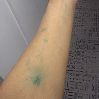 Pastadaki Yoğun Mavi Boya Lekeleri Ve İlgisiz Firma Tutumu