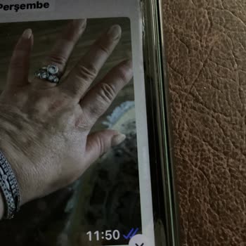 Sürekli Gevşeyen Bileklik Ve Tekrarlanan Tamirler Sonrası Kayıp