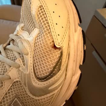 New Balance 530 Modelinde Tekrarlayan Yan File Yırtılma Sorunu