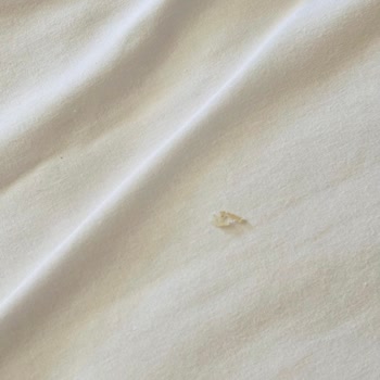 Otel Odalarında Ve Ortak Alanlarda Ciddi Hijyen Sorunları
