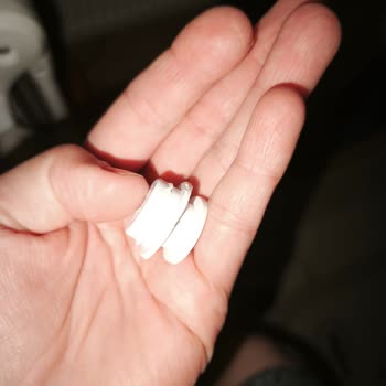 Eksik Ve Kırık Parçalar Nedeniyle Ayakkabılık Montajı Başarısız