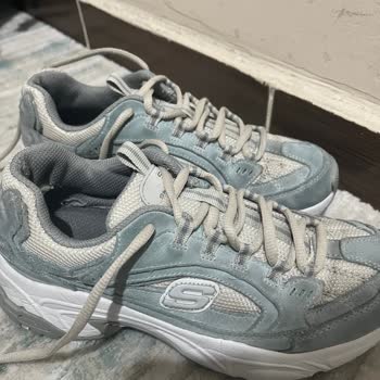 Skechers Stamina Ayakkabısında Renk Değişimi Ve Arka İç Yırtılma