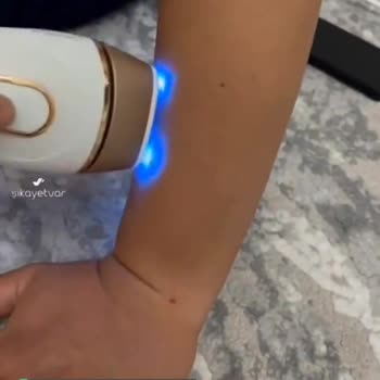 Braun Silk Expert Pro 5 Atış Yapmama Sorunu