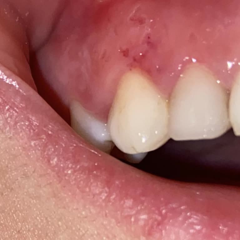 Karpuzoğlu Diş Kliniği İşlerini Düzgün Yapmıyorlar
