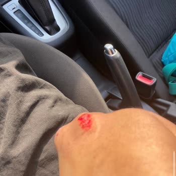 Motosiklet Kursunda Güvenlik İhmali Ve Hukuki Baskı