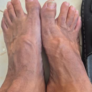 Ayaklarımı Boyayan Siyah Terlik İçin Ücret İadesi