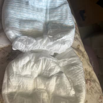 Molfix Bebek Bezlerinde Aynı Ambalajda Kalite Farklılığı Çocuğumda Şiddetli Tahrişe Yol Açtı