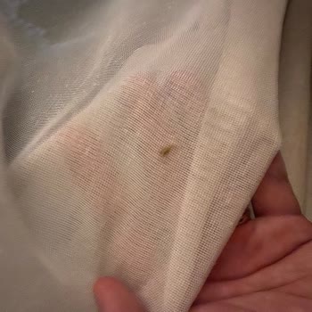 Sağlığımızı Tehlikeye Atan Hijyen Ve Hizmet Sorunları Nedeniyle Tam İade Talebi