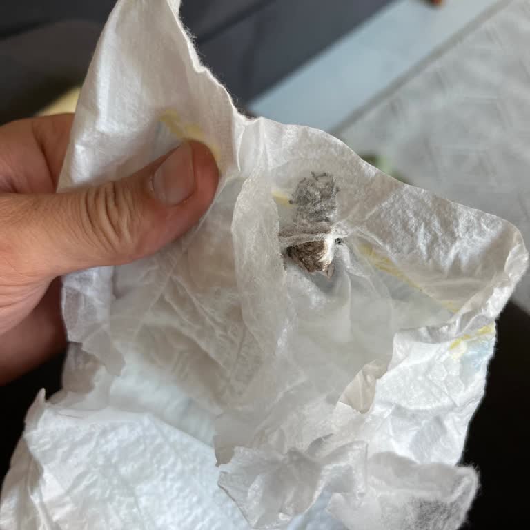 Bebeğimizin Bezinde Yabancı Cisim Görülmesi Güvenimizi Sarstı