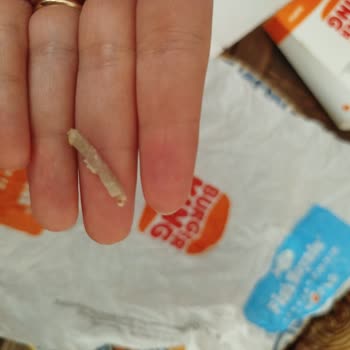 Burger King Menüsünde Tavuk Tırnağına Benzeyen Yabancı Madde Bulundu