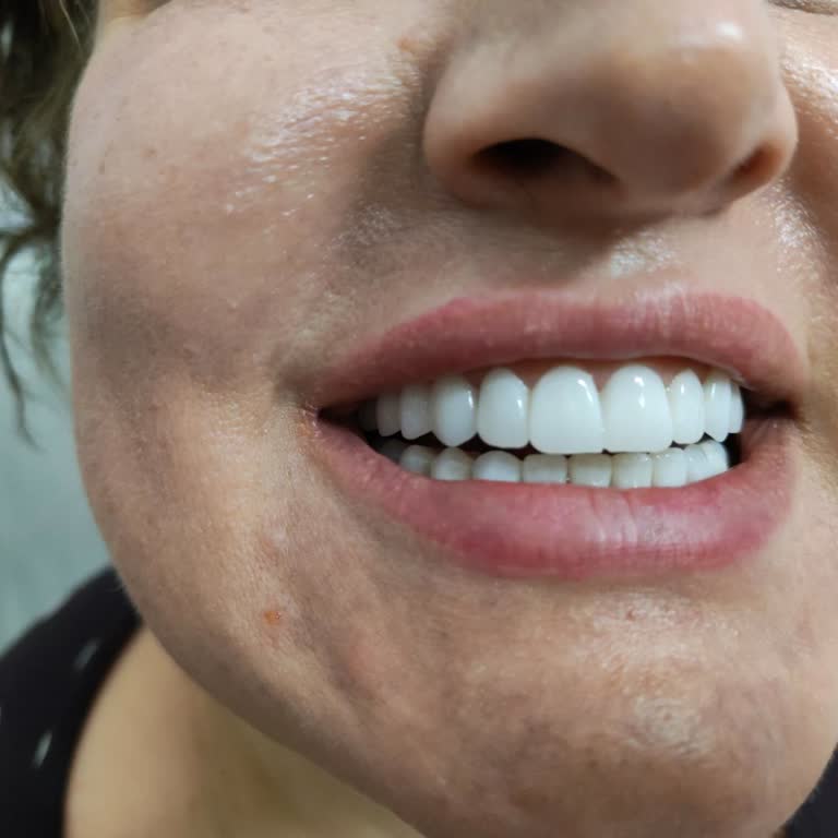 Yanıltıcı Zirkonyum Garantisi, Hekim İhmali Ve Tehditkar Klinik Tutumu