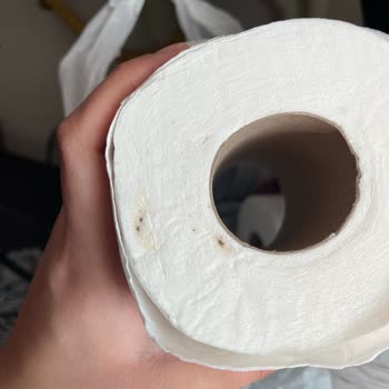 Selpak Tuvalet Kağıdındaki Kahverengi Lekeler Ve Şikayet Sürecindeki Sorun